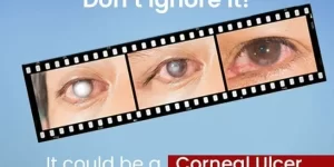 Cornea Surgery in India